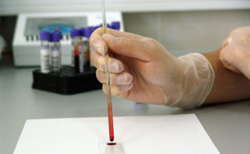 Hematologia – wizyta u lekarza, diagnostyka chorób, podstawowe badania Hematologia – wizyta u lekarza, diagnostyka chorób, podstawowe badania