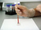 Hematologia – wizyta u lekarza, diagnostyka chorób, podstawowe badania Hematologia – wizyta u lekarza, diagnostyka chorób, podstawowe badania
